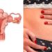 How To Prevent Death From Fibroids – Expert 5 How To Prevent Death From Fibroids – Expert