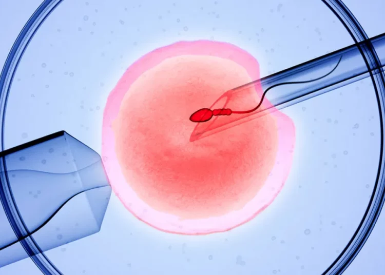 IVF