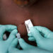 monkeypox