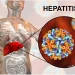 Hepatitis: Why Nigeria May Not Achieve Elimination Target By 2030