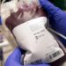 Curbing Menace Of Unregulated Blood Service In Nigeria