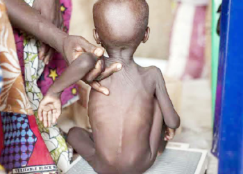 Lagos  And Its Bid To End Malnutrition
