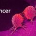 Cancer