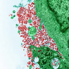 Fragmented Approaches Hampering Control Of Rabies Disease - AU 1 Rabies