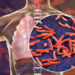Governors Tasked On Tuberculosis Scourge