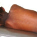 Measles: 190 Children Killed As Cases Hit 18,577 In 36 States, FCT