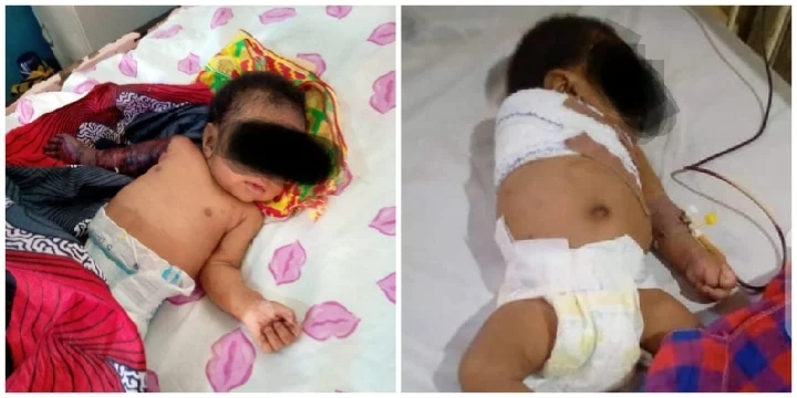 2-month-old Imo Baby Amputated After Assault By Father 1 Baby Amputated After Assault By Father jpg