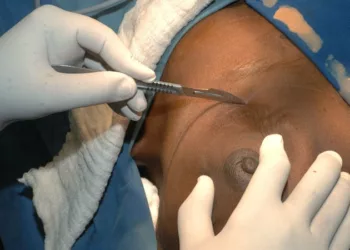 Experts Seek Early Detection As Nigeria Records 28,380 New Cases Of Breast Cancer