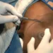 Experts Seek Early Detection As Nigeria Records 28,380 New Cases Of Breast Cancer