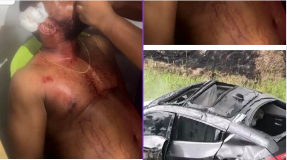 Lead Singer Of Gov Wike's Live Band Survives Fatal Road Crash 1 Capture