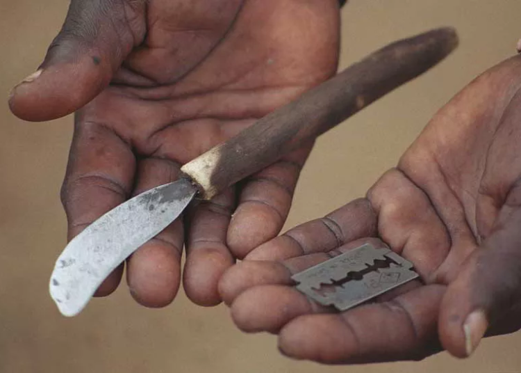 Report FGM Practice To Police, Amotekun, Civil Defence 1 An image used to illustrate Female Genital Mutilation jpg