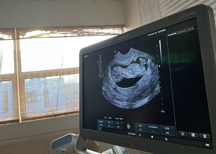 Tennis Star, Naomi Osaka, Announces Pregnancy, Plans Return In 2024 1 IMG 20230111 WA0057 jpg
