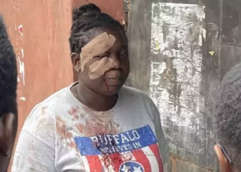 Bruised But Unbowed: Woman Votes In Lagos After Attack