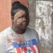 Bruised But Unbowed: Woman Votes In Lagos After Attack