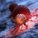 Closing Cancer Care Gap   