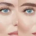 Tattooing Of Eyebrows Can Cause Infections, Keloid, Dermatologist Says 5 Tattooing Of Eyebrows Can Cause Infections, Keloid, Dermatologist Says