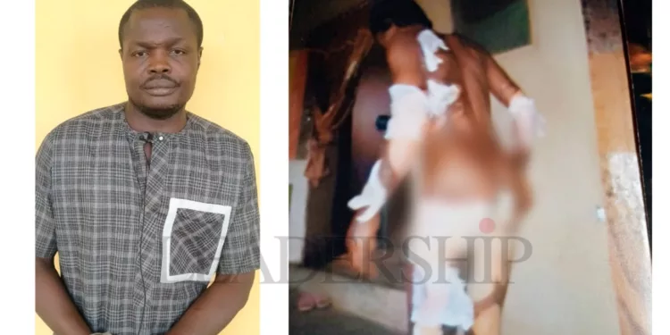 Man sets wife ablaze