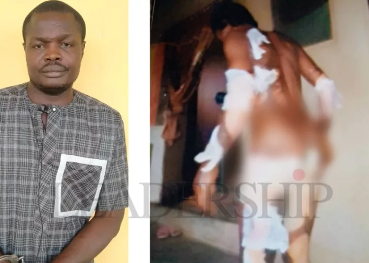 Man sets wife ablaze