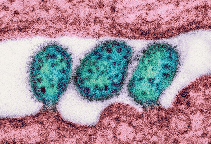 Outbreak Of Lassa Fever 1 lassa 1