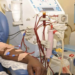 18,000 Nigerians Need Dialysis Yearly – Nephrologists 4 18,000 Nigerians Need Dialysis Yearly – Nephrologists