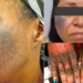 Despite Health Hazards, Bleaching Creams Remain Top Taste For Nigerian Women