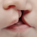 What You Need To Know About Orofacial Cleft