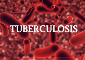 Anambra Records 26,000 TB Cases In 3 Months