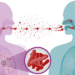 Tuberculosis In Children, How To Prevent It 5 Tuberculosis In Children, How To Prevent It