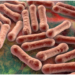 Diphtheria: 26 Die, 21 Hospitalised In Yobe
