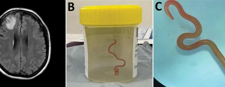 The worm was about 8cm long and was wriggling [Courtesy of ANU]