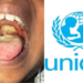 Diphtheria Killed 122 In Nigeria - UNICEF 5 Diphtheria Killed 122 In Nigeria – UNICEF