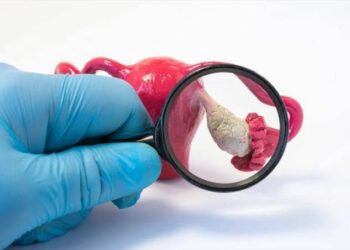 PCOS: The Pains Women Go Through