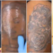 I Regret Tattooing Naira Marley’s Face On My Body, Says Skit Maker Mandy Kiss 5 I Regret Tattooing Naira Marley’s Face On My Body, Says Skit Maker Mandy Kiss