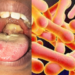 Nigeria Records 453 Deaths, 11,587 Suspected Diphtheria Cases 5 Nigeria Records 453 Deaths, 11,587 Suspected Diphtheria Cases