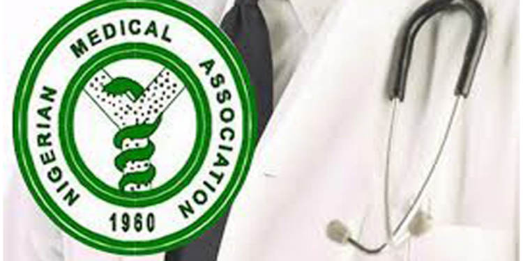 NMA