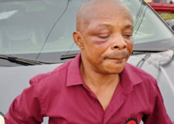 NLC President Ajaero Brutalised By Policemen, Rushed To Hospital For Treatment