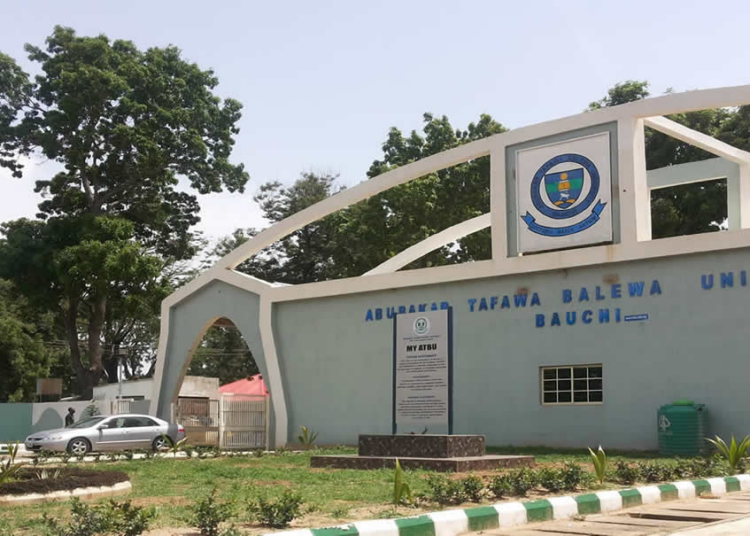 Bauchi Hospital Performs First Kidney Stone Surgery