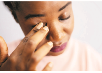 Conjunctivitis: Why Treating Apollo With Urine, Breast Milk Should Be Discouraged