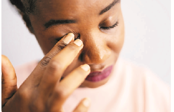 Conjunctivitis