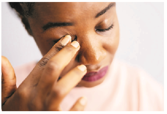 Conjunctivitis: Why Treating Apollo With Urine, Breast Milk Should Be Discouraged 1 apollo