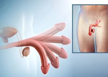 Erections Over 30 Minutes Dangerous, Don Warns Men