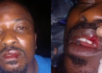 Police Allegedly Brutalise, Detain Lagos Resident For Questioning Car Seizure