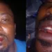 Police Allegedly Brutalise, Detain Lagos Resident For Questioning Car Seizure 5 Police Allegedly Brutalise, Detain Lagos Resident For Questioning Car Seizure