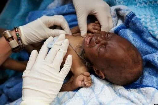 Number Of HIV Patients Among Children On Increase In Gombe - Agency 1 IMG 3768