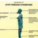 A Look Into The Daily Life Of Those Living With Stiff Person Syndrome