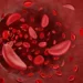 US Agency Approves Cure For Sickle Cell Disease 10 US Agency Approves Cure For Sickle Cell Disease