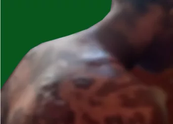 Woman Seeks Soludo’s Help After Landlady Pours Hot Water, Pepper on Her In Anambra