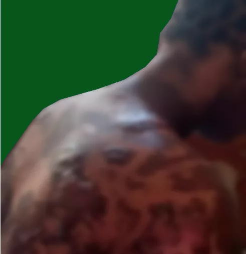 Woman Seeks Soludo's Help After Landlady Pours Hot Water, Pepper on Her In Anambra 1 the womans back jpg