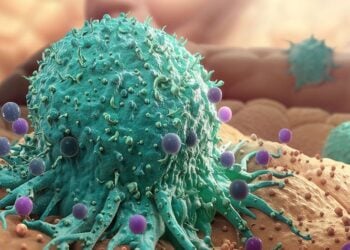 Cancer Patients Continue To Die With Little Or No Treatment