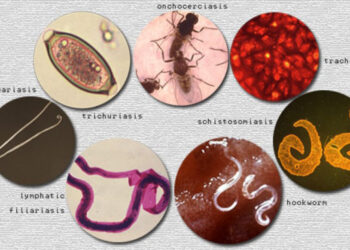 Nigeria’s Hidden Burden Of Neglected Tropical Diseases